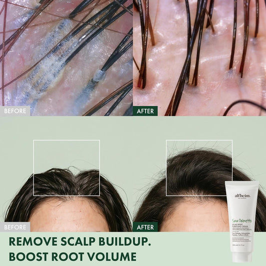 Saw Palmetto Scalp Reset Purifying Cream