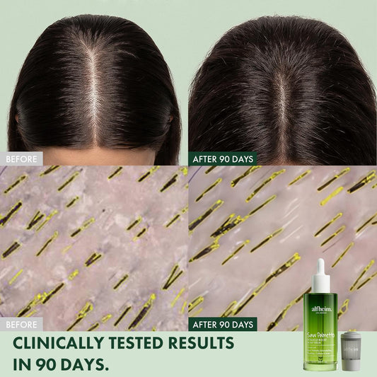 Saw Palmetto Follicle Boost Scalp Serum