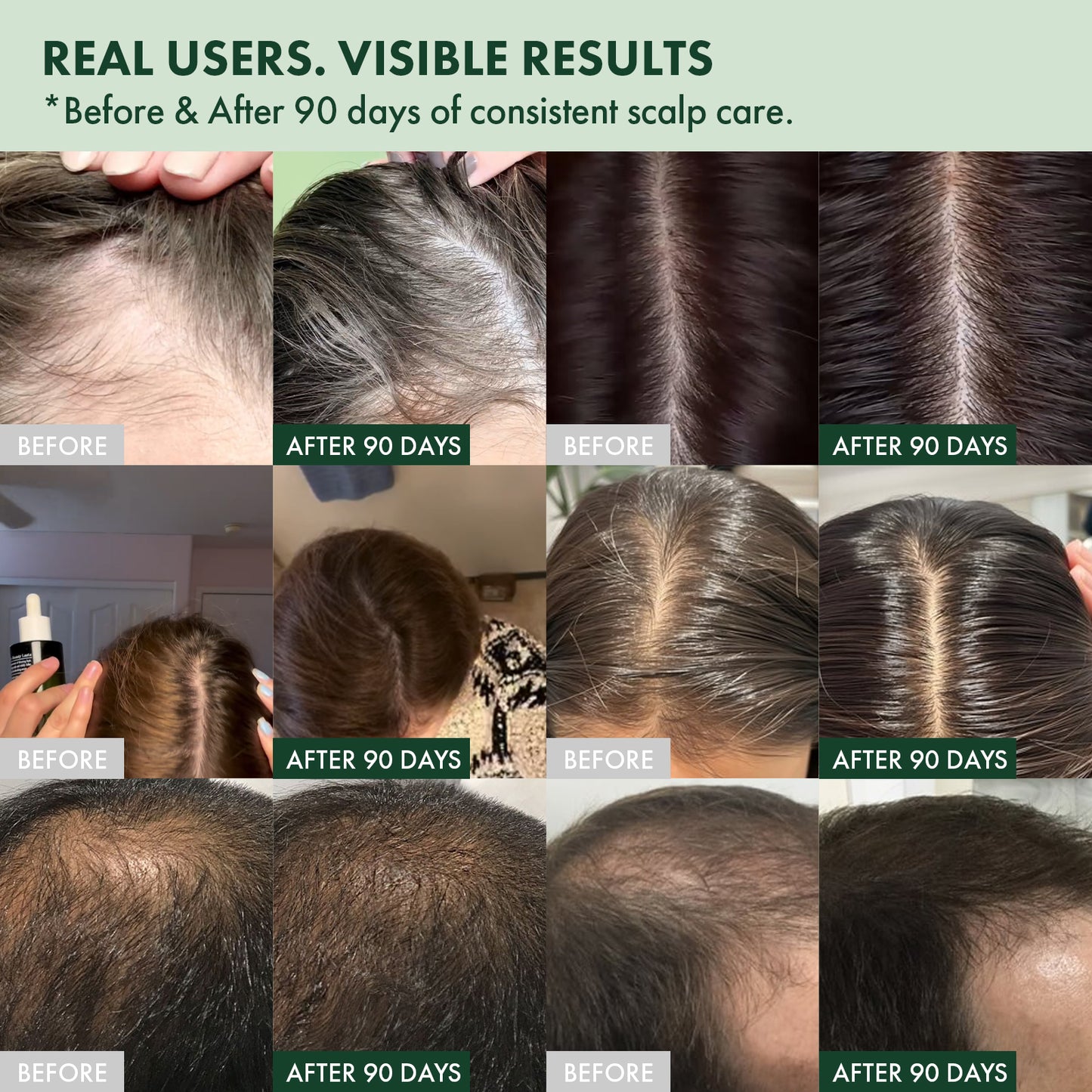 Saw Palmetto Follicle Boost Scalp Serum