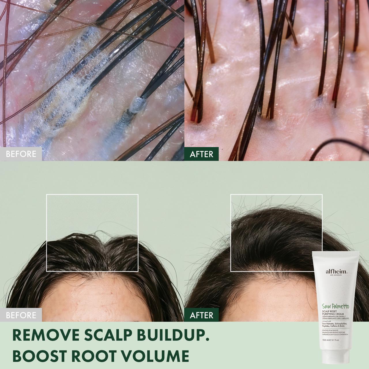 Saw Palmetto Scalp Reset Purifying Cream