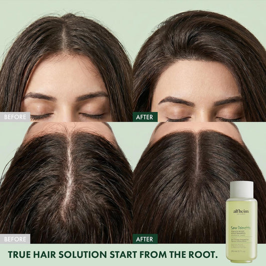 Saw Palmetto Follicle Boost Scalp Shampoo
