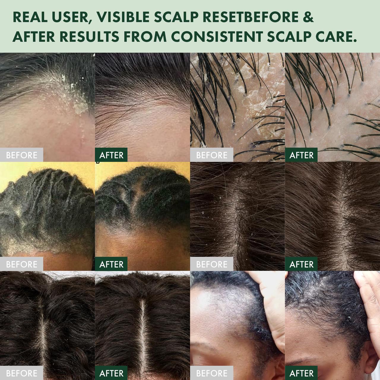 Saw Palmetto Scalp Reset Purifying Cream