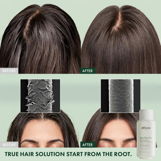 Saw Palmetto Follicle Boost Scalp Conditioner