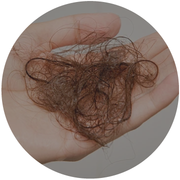 Hair Loss & Thinning