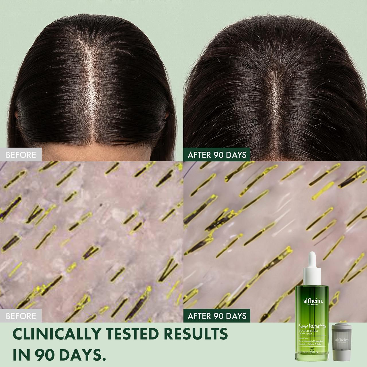 Saw Palmetto Follicle Boost Scalp Serum