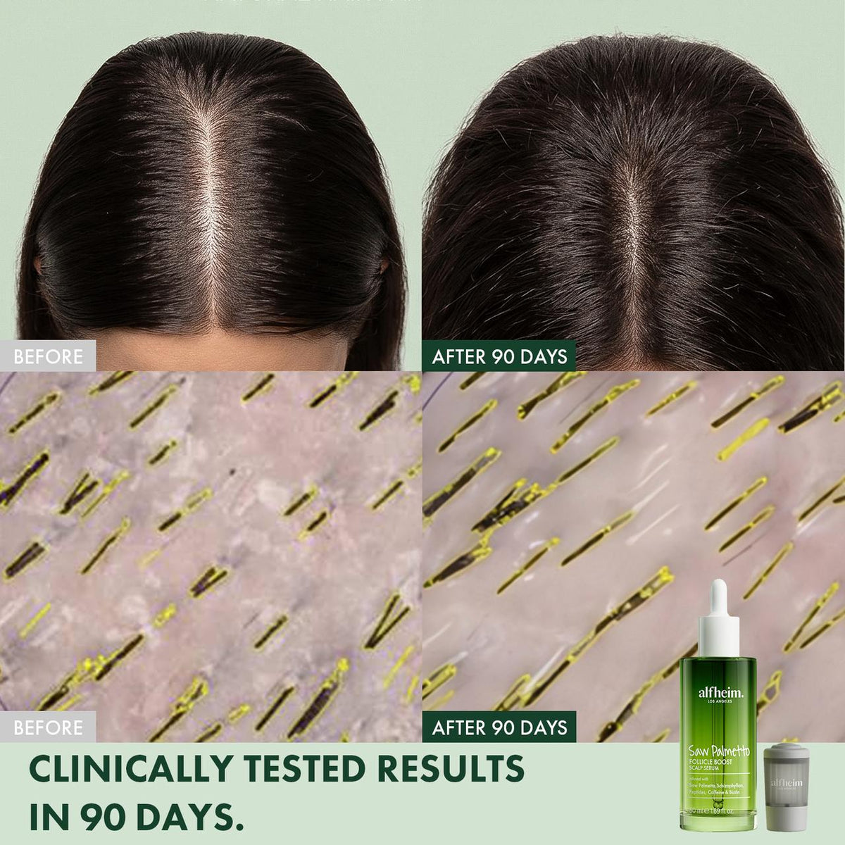 ALFHEIM Saw Palmetto Follicle Boost Intensive Scalp Serum - product detail 2
