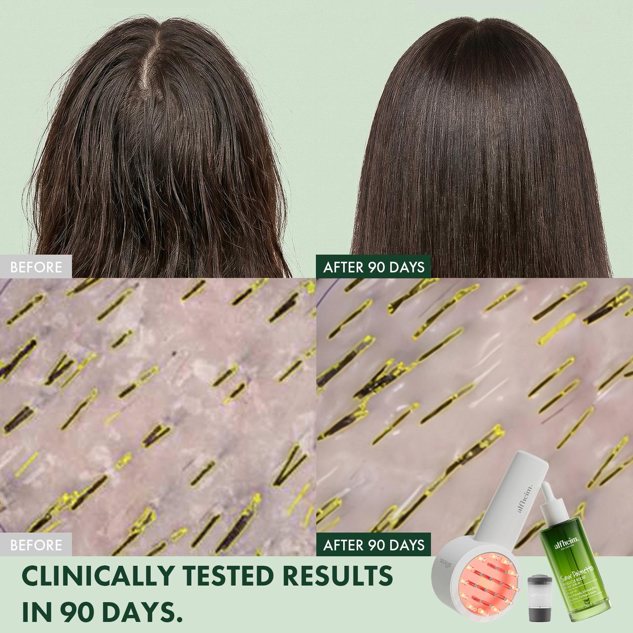 Red Light Scalp Serum Applicator Set